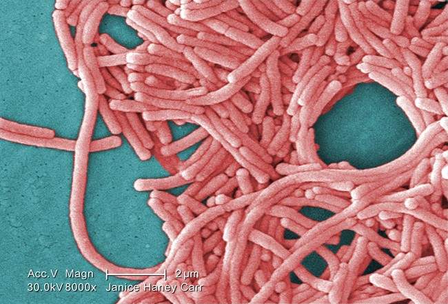 This 2009 colorized 8000X electron micrograph image provided by the Centers for Disease Control and Prevention shows a large grouping of Gram-negative Legionella pneumophila bacteria. 