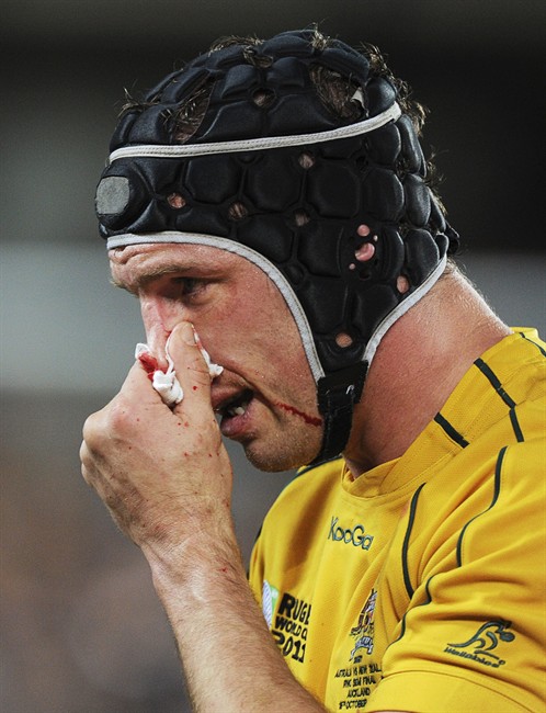 Australia's Dan Vickerman leaves field with bloody nose during their Rugby World Cup semifinal against New Zealand All Blacks at Eden Park, Auckland, New Zealand, Sunday Oct 16, 2011. (AP Photo/Ross Land).