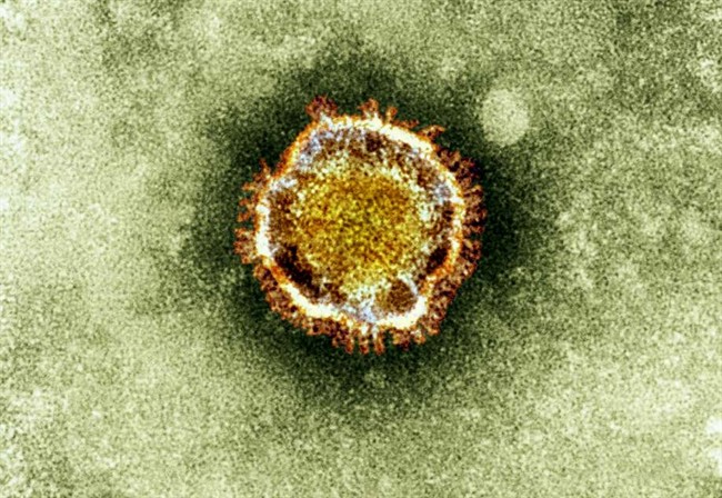 FILE - In this undated file image released by the British Health Protection Agency shows an electron microscope image of a coronavirus, part of a family of viruses that cause ailments including the common cold and SARS, which was first identified last year in the Middle East. 