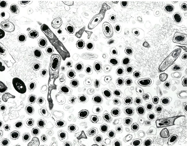 Bacillus anthracis spores are pictured in this undated photomicrograph from the official U.S. Department of Defense anthrax information Web Site.
