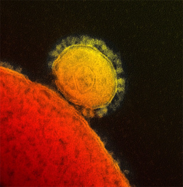 Progress in MERS research may be in sight - image