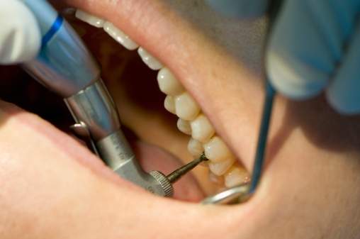 Dental patients at Lakeland Clinic in Lindsay who received treatment from November 2017 to February 2018 are urged to be tested for HIV and hepatitis.