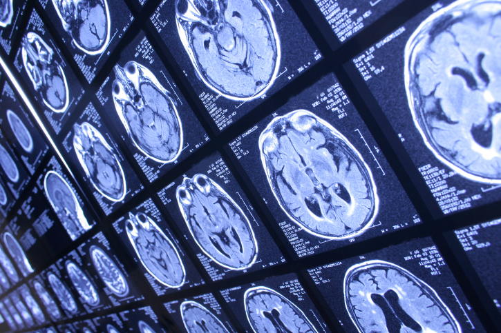 The Saskatoon Health Region says diagnostic images of 206 patients, including CT scans and X-rays have been lost in archives.