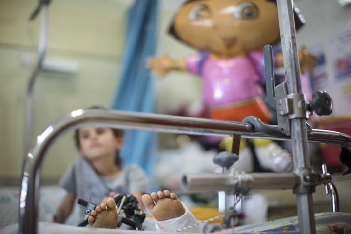 A wounded Syrian child is treated at the Israeli Ziv hospital on August 28, 2013 in the northern town of Safed, Israel. 
