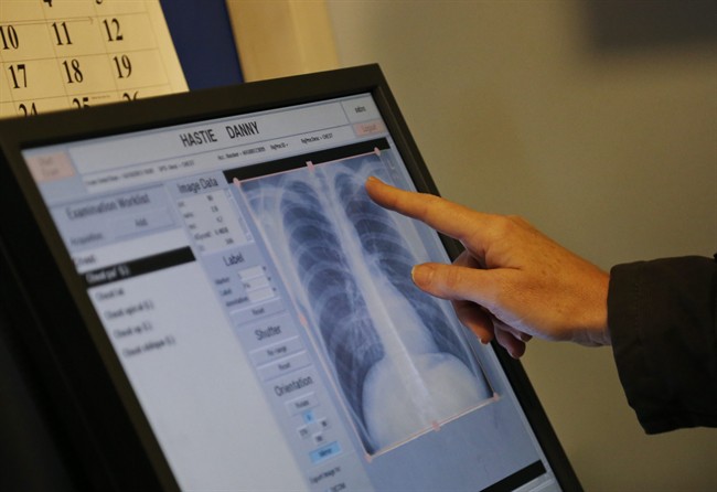 In this Wednesday, Oct. 16, 2013 photo, a radiographer reads an X-ray.