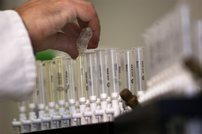 FILE - In this Feb. 5, 2010 file photo, a laboratory technician prepares samples of urine for doping tests during a media open day, at the King's College London Drug Control Centre, London.