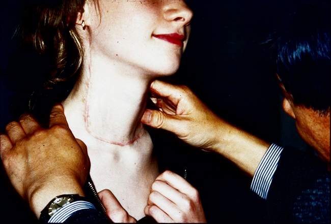 Dr. Akira Sugenoya checks the throat of a patient who went through a surgery to treat Chernobyl thyroid cancer at the Balarus Thyroid Cancer Center in Minsk, Belarus. 