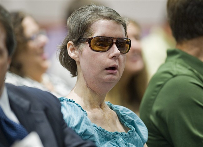 FILE – In this Aug. 10, 2012 file photo, Charla Nash sits before a hearing at the Legislative Office Building in Hartford, Conn., to determine whether she may sue the state for $150 million in claimed damages.