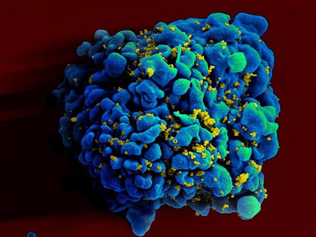 An experimental drug given in periodic shots completely protected monkeys from infection in two studies reported at an AIDS conference.