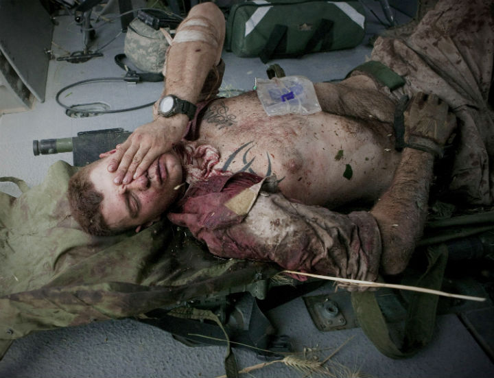 In this June 4, 2011 photo, injured U.S.Marine Cpl. Burness Britt reacts after being lifted onto a medevac helicopter from the U.S. Army’s Task Force Lift “Dust Off,” Charlie Company 1-214 Aviation Regiment.