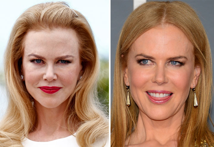 Nicole Kidman face