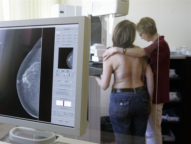 Mammogram