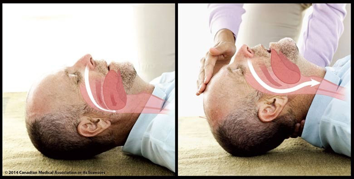 We’re doing CPR all wrong, Canadian doctor suggests - image
