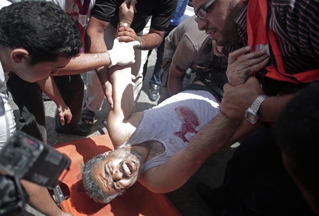 Palestinian medics place an injured man on a stretcher in the Shifa hospital after an Israeli missile strike in Gaza City on Saturday, July 12, 2014. Palestinian officials said Israeli airstrike hit a group of people sitting in front of a closed shop killing several, raising the Palestinian death toll to more than 120 during an Israeli offensive that showed no signs of slowing down. (AP Photo/Khalil Hamra)