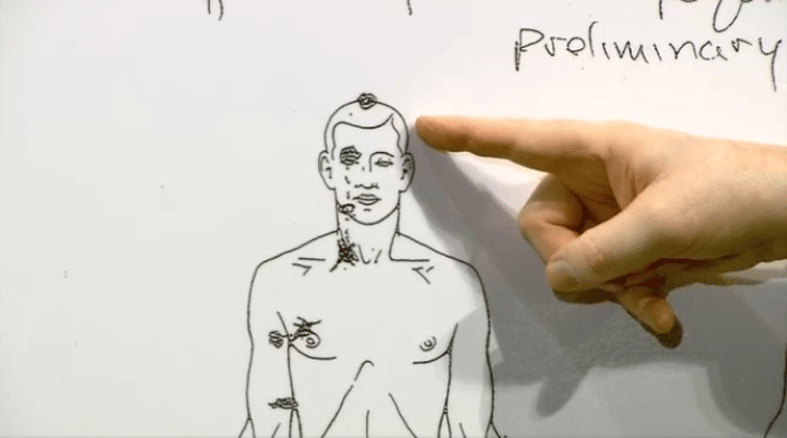 Michael Brown autopsy chart