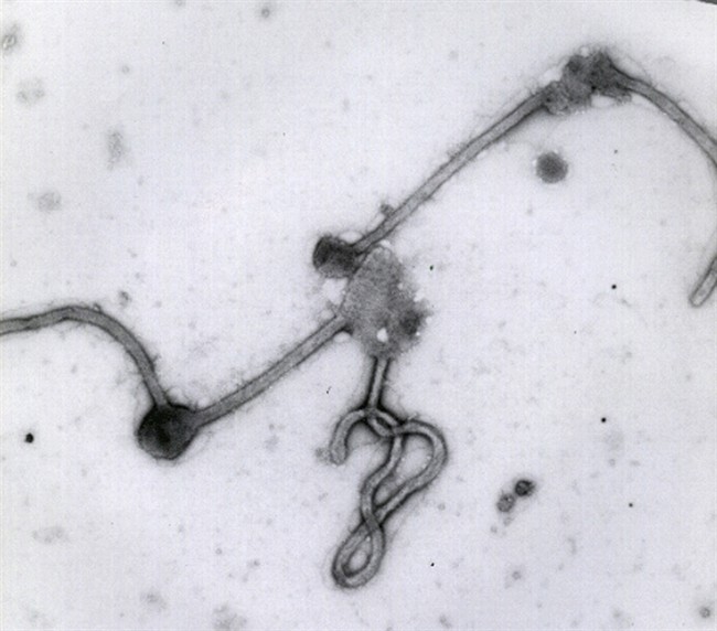Ebola virus