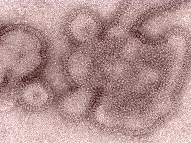 Saskatchewan influenza activity on the rise with experts urging flu vaccine - image