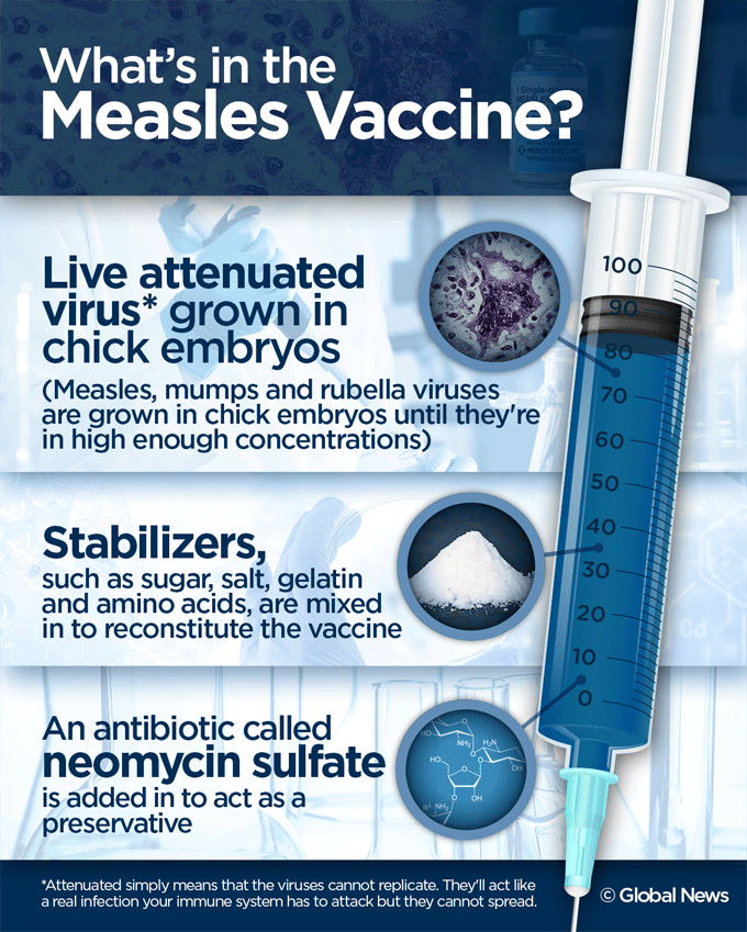UPDATE: 136 measles cases in Lanaudière - image