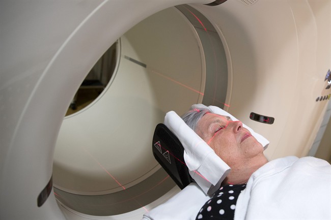 Study peeks into healthy brains to hunt Alzheimer’s culprit - image