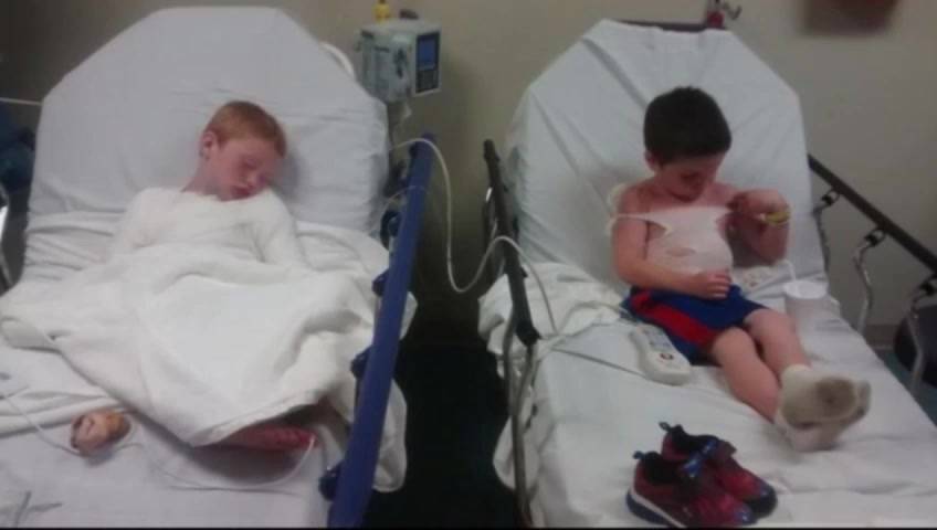 Boys who suffered horrific sunburns were in the sun less than 2 hours - image
