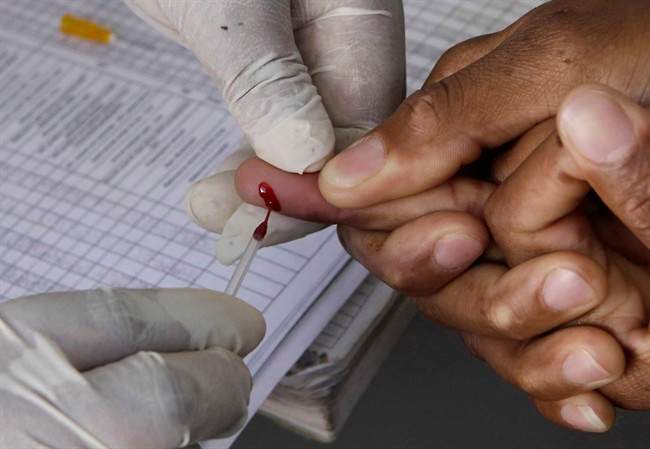 More than 98 per cent of the HIV sequences collected in Saskatchewan had at least one major immune-resistant mutation.