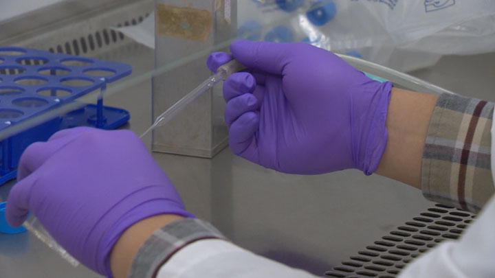 Researchers in Saskatchewan hope a simple blood test will help detect a concussion sooner.
