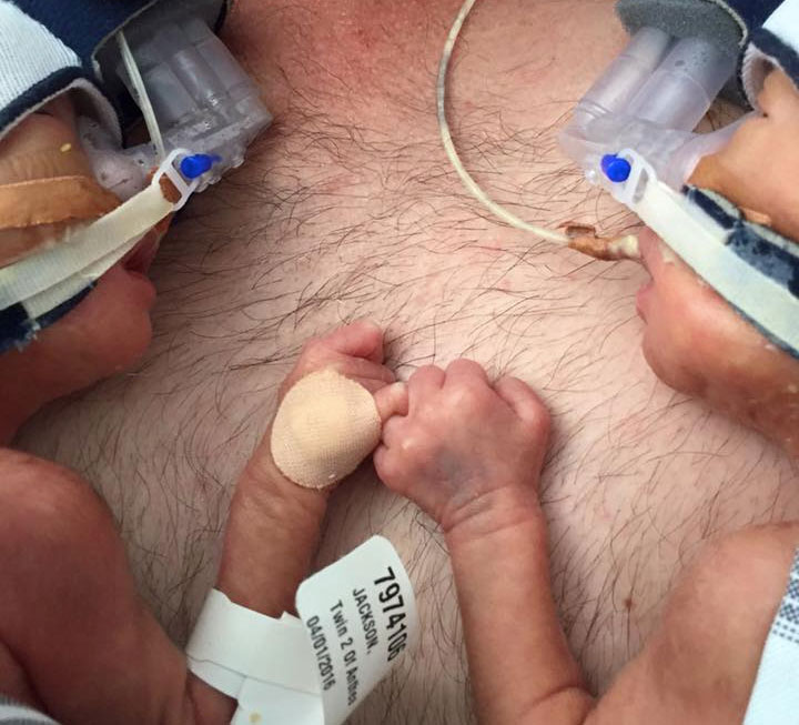 Premature twins clutch on to each other’s hands after being born 11 weeks too early.