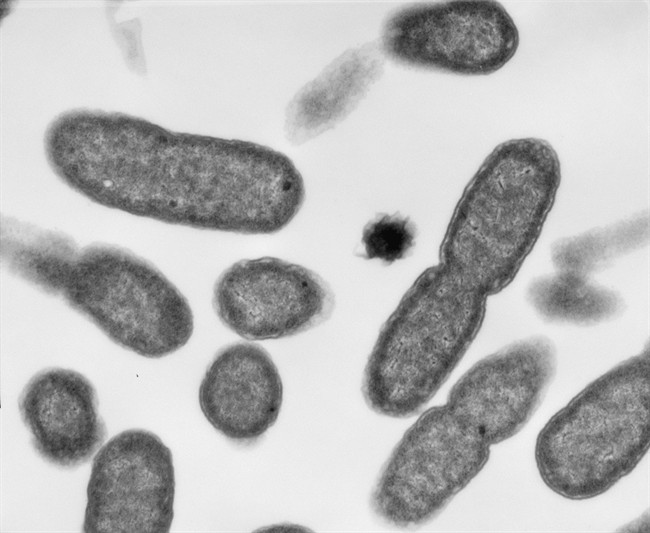 Cobourg's West Harbour is closed for swimming due to high levels of E. coli bacteria.