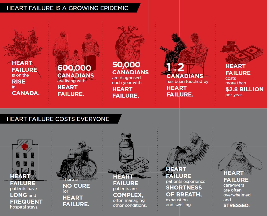 Heart failure rates rising in Canada: Heart and Stroke Foundation - image