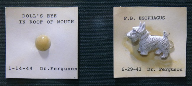 Yuck! The weird things kids swallow go on display - image