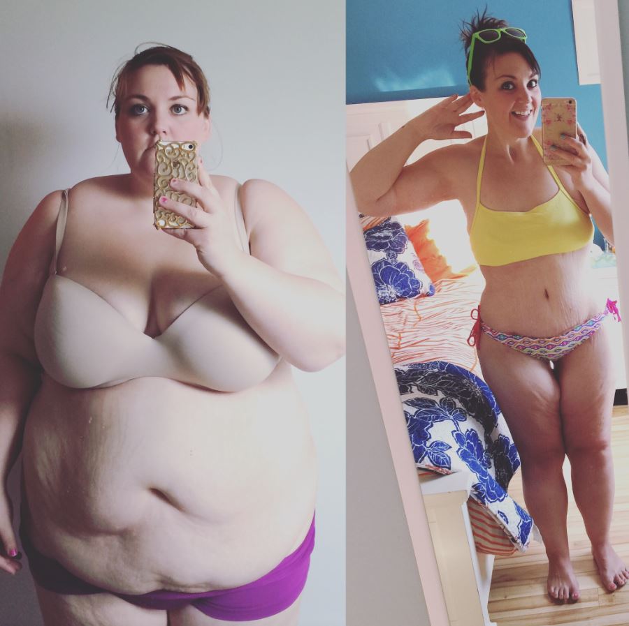 Mallory Buettner before and after.