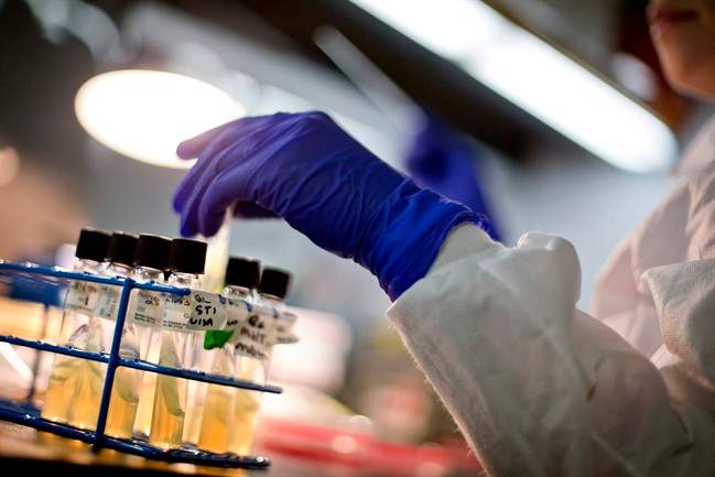 File - A University of New Brunswick researcher is set to lead Canada's fight against antimicrobial resistance.