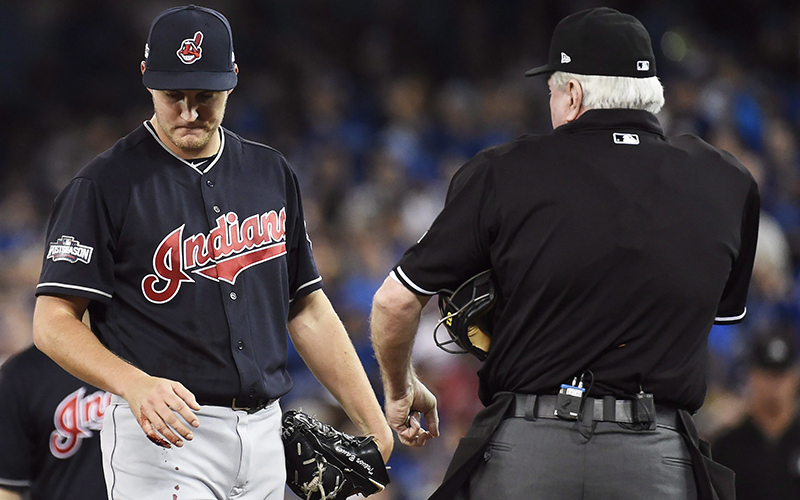 Cleveland Indians starting pitcher Trevor Bauer looks at his bleeding finger against the Toronto Blue Jays during first inning, game three American League Championship Series baseball action in Toronto on Monday, October 17, 2016. 