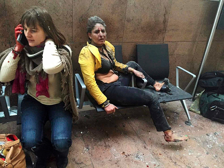 Nidhi Chaphekar, a 40-year-old Jet Airways flight attendant, is seen after being wounded in Brussels Airport in Belgium after explosions rocked the airport on March 22, 2016.