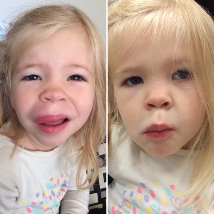 Families with severe food allergies not happy with McDonald’s recent decision - image