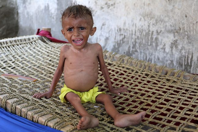 A malnourished Yemeni boy sits on a wooden bench on September 26, 2016 in an impoverished coastal village on the outskirts of the rebel-held Yemeni port city city of Hodeida, where malnutrition has hit the population hard. 