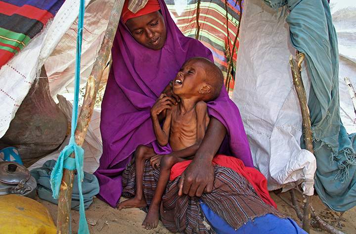 In this photo taken Tuesday, March 28, 2017, a newly displaced Somali mother comforts her malnourished child in their makeshift shelter at a camp in the Garasbaley area on the outskirts of Mogadishu. 