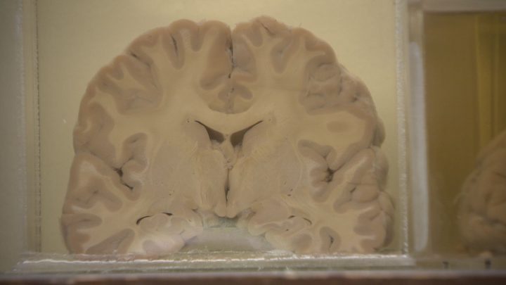 The silent tutor: how your body can help medicine and science - image