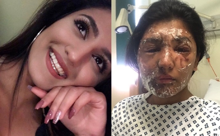 Resham Khan, 21, is suffering from severe burns to her face and body after a man threw acid at her and her cousin while stopped at traffic lights in London.