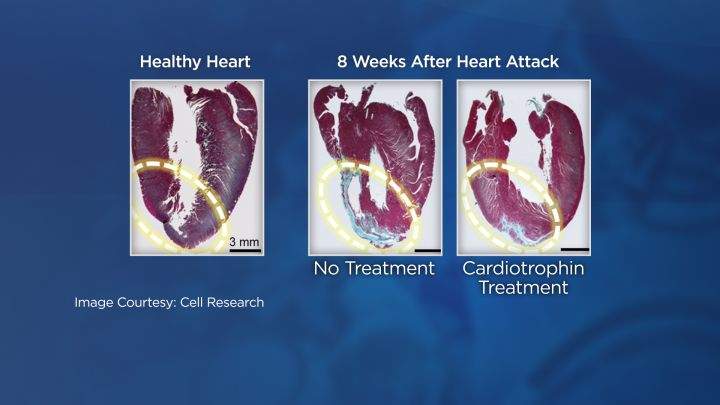 Ottawa researchers target ‘exercise’ protein to help people with right-side heart failure - image