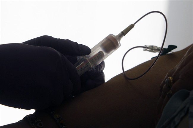 FILE: Doctors in New Brunswick are pushing back against proposed Federal tax changes.