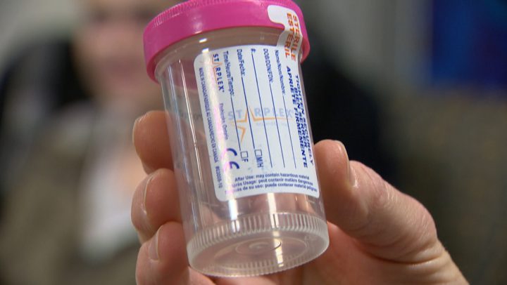 The U of S is aiming to test more than one thousand people for chlamydia and gonorrhea in a single day.