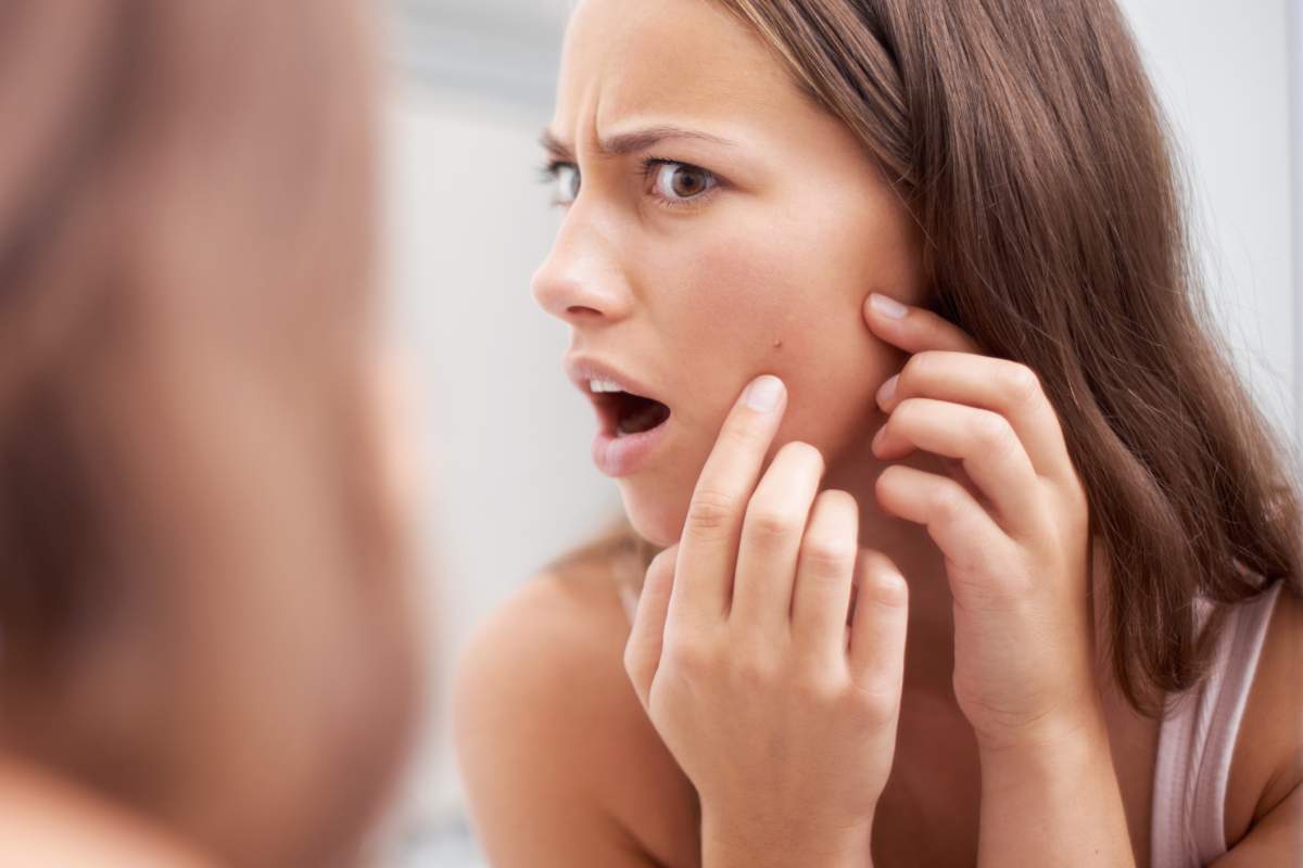 Having a poor diet low in certain vitamins and minerals can impact the quality of your skin, experts say.