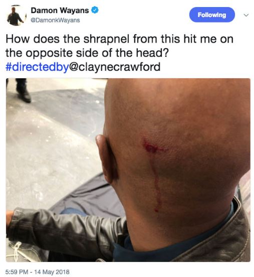 ‘Lethal Weapon’ star Damon Wayans posts video, photos accusing Clayne Crawford of on-set violence - image