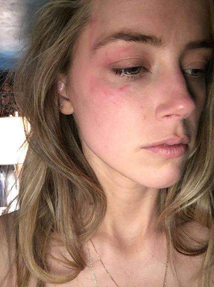 Johnny Depp claims Amber Heard punched him ‘twice in the face’ - image
