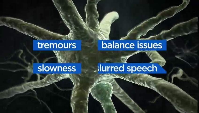There are more than 40 non-motor symptoms associated with Parkinson’s.