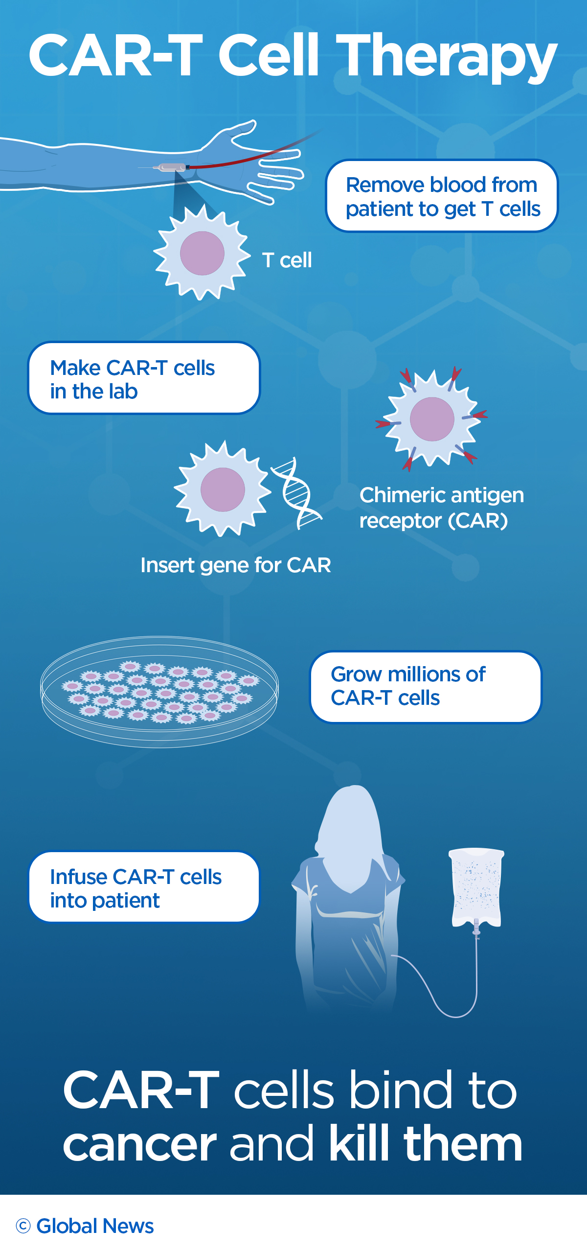 Immune system fights cancer: How one boy beat leukemia with new treatment - image