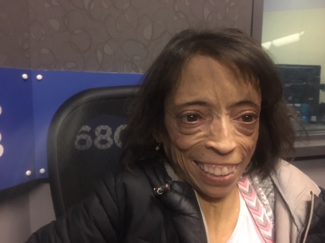 Rose Pallone has been receiving treatment at CancerCare Manitoba for 48 years. She told 680 CJOB the clinic is now too busy to serve all its patients. 
