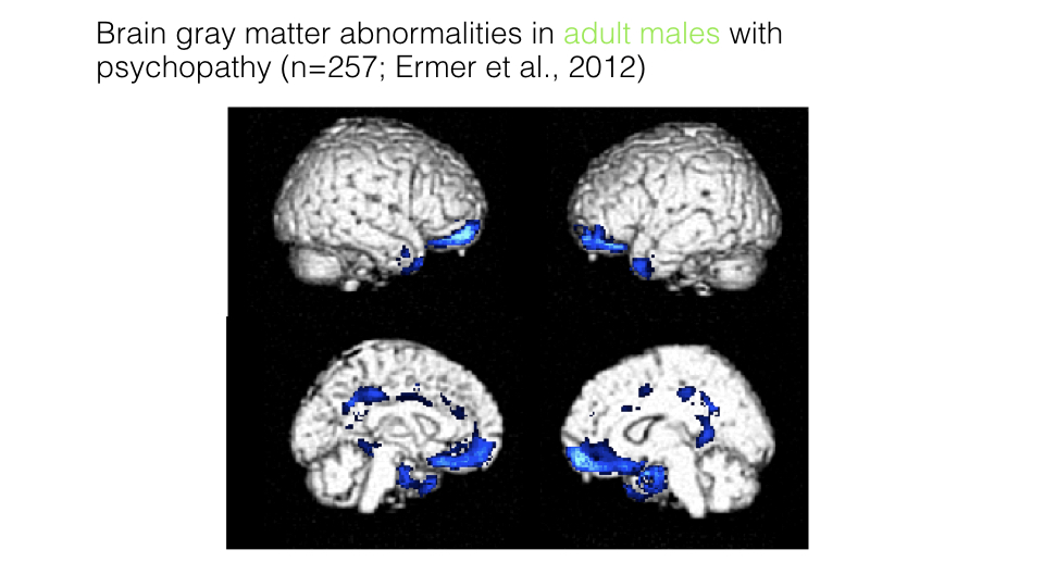 Brain gray matter abnormalities in adult males with psychopathy.