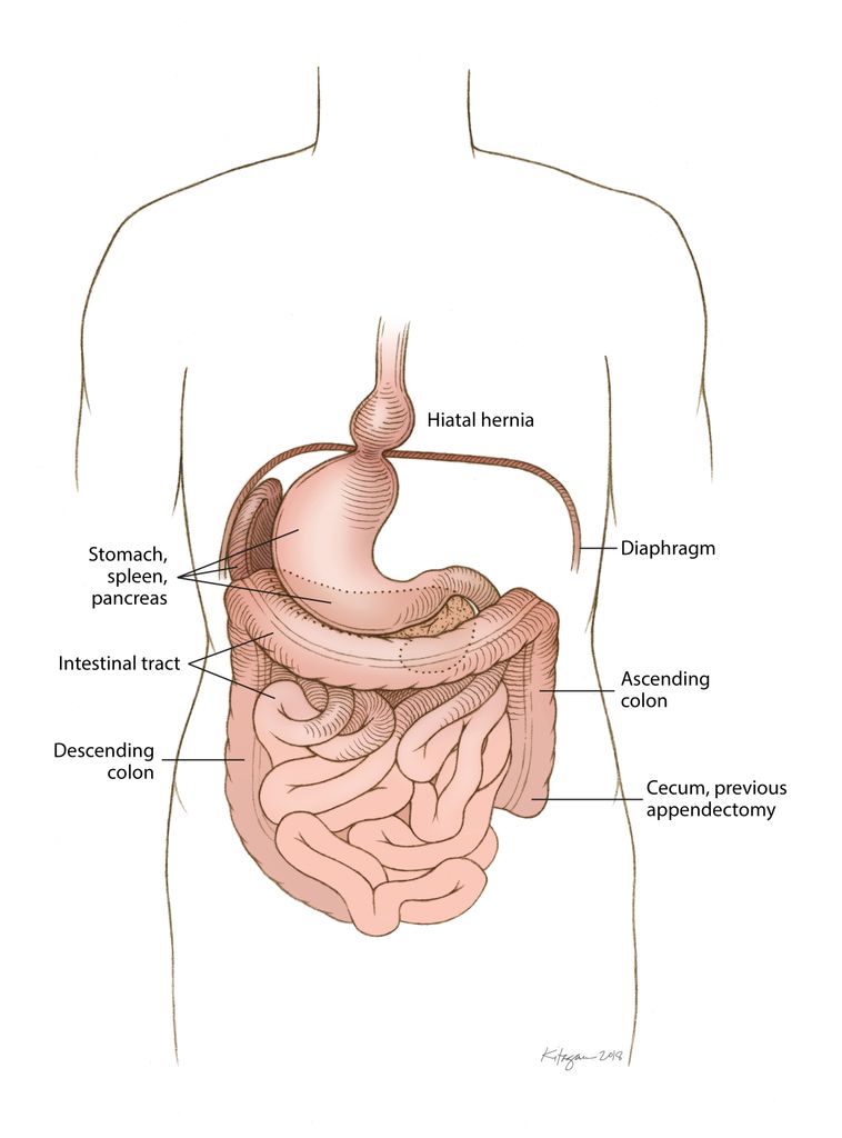 For 99 years, some of her organs were out of place: ‘A medical mystery’ - image